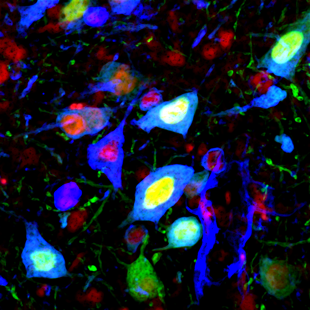 Colorful micrograph of neural images