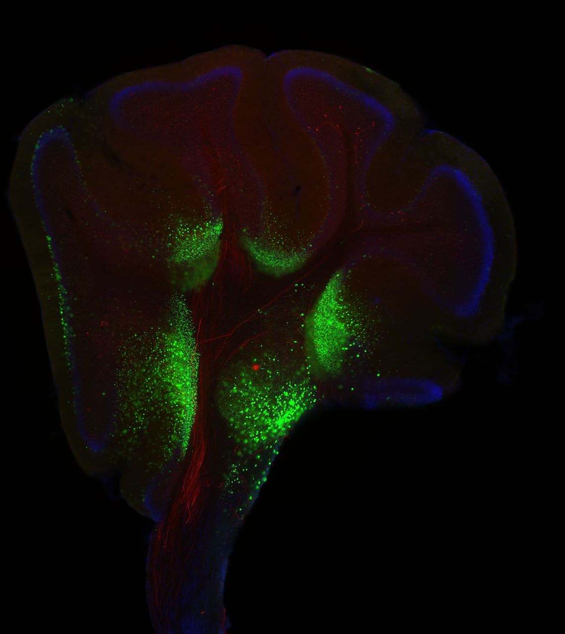 Cerebellum