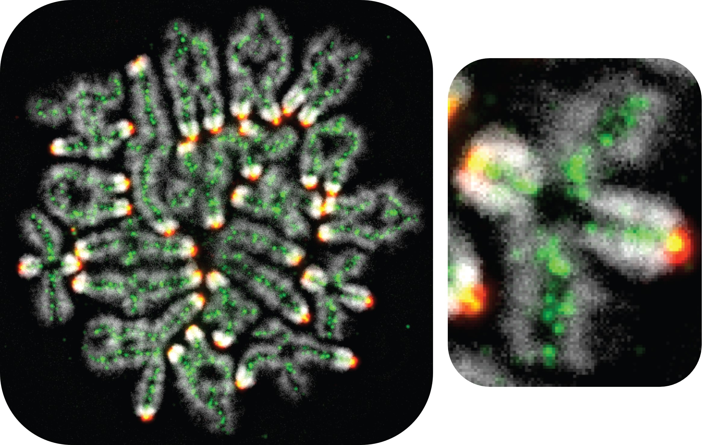 Fluorescent microscopy image of mouse oocyte chromosomes at metaphase I of meiosis. The chromosomes appear as white structures with green and red fluorescent markers indicating crossover sites and chromosome ends. A magnified inset on the right shows detailed localization of these markers.