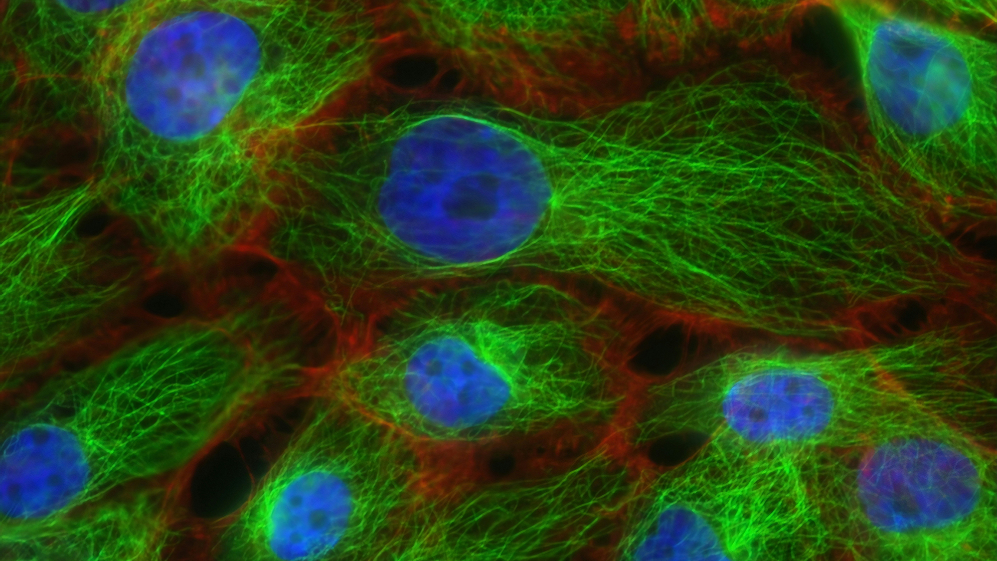 Stress fibers and microtubules in human breast cancer cells. (National Cancer Institute)