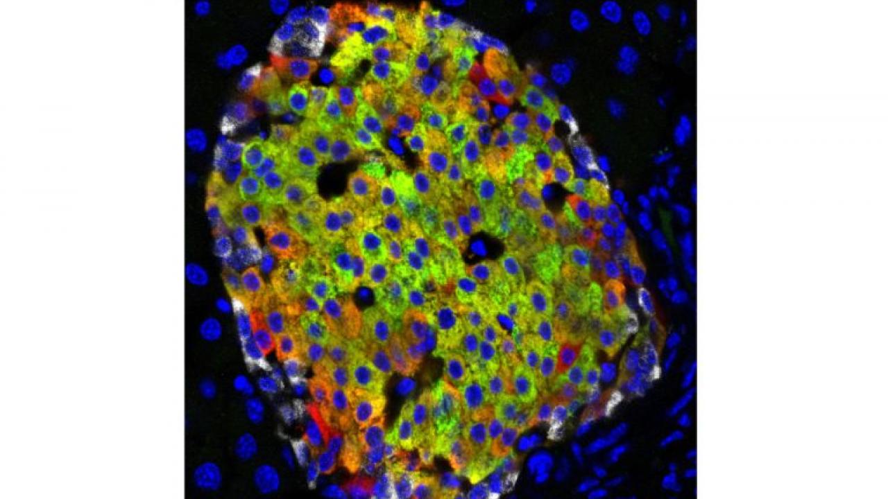 Pancreatic islets make insulin in response to blood glucose. In this image, cells are stained red for insulin and green for a marker of mature beta cells, so the mature cells are green/orange. Red cells at the edges are a newly discovered type of immature insulin-producing cell. Mark Huising/UC Davis Pancreatic islets make insulin in response to blood glucose. In this image, cells are stained red for insulin and green for a marker of mature beta cells, so the mature cells are green/orange. Red cells at the edges are a newly discovered type of immature insulin-producing cell. Mark Huising/UC Davis
