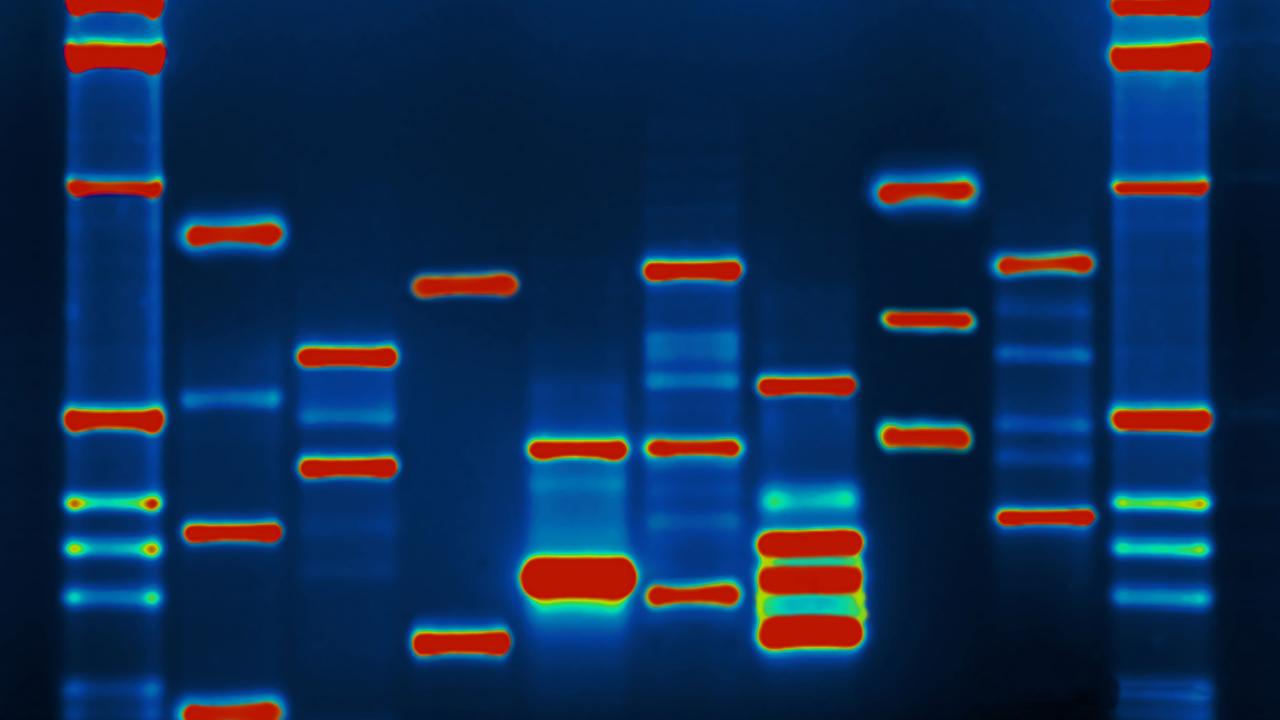 DNA Profile. Micah Baldwin DNA Profile. Micah Baldwin
