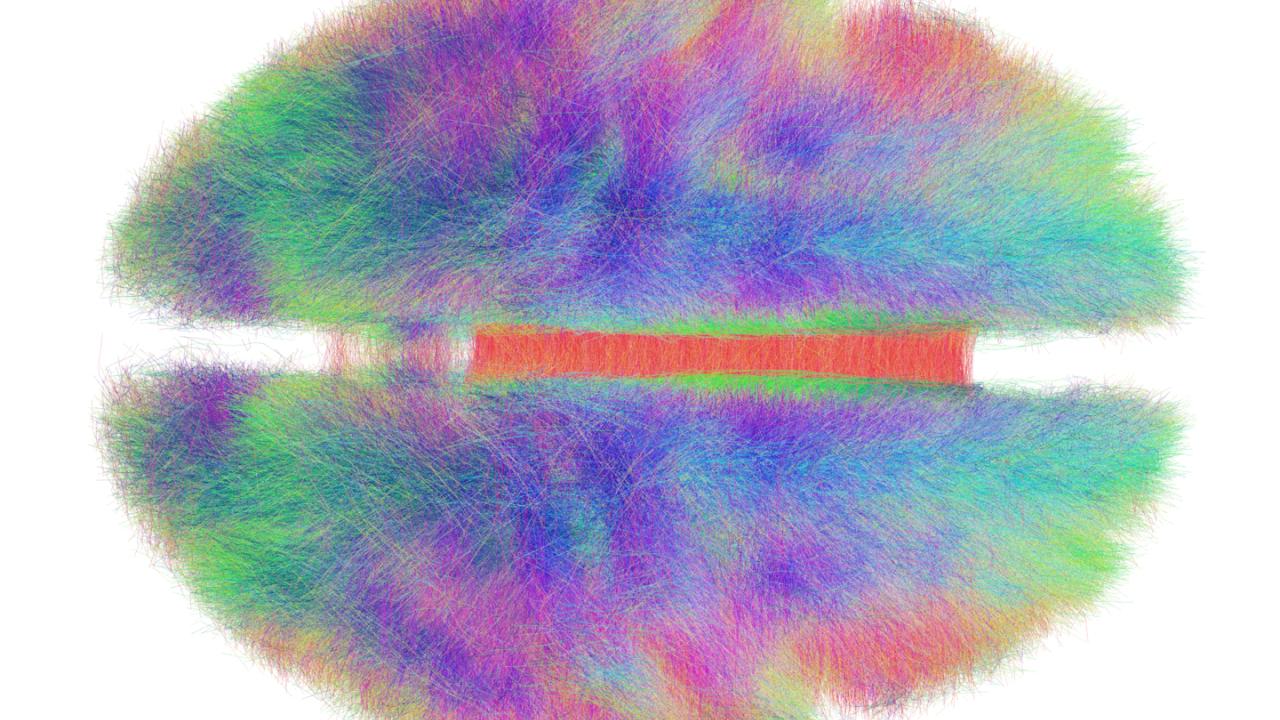 Big data visualization techniques like this connectome—a computer-generated map of the brain pathways of 20 humans—inform neuroscience and help create models of complex biological systems. Andreas Horn/Max Planck Institute for Human Development Big data visualization techniques like this connectome—a computer-generated map of the brain pathways of 20 humans—inform neuroscience and help create models of complex biological systems. Andreas Horn/Max Planck Institute for Human Development
