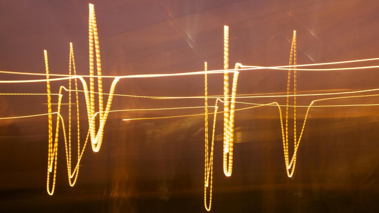 Golden light trails form jagged, wave-like lines against a dark background, resembling an abstract heart monitor.