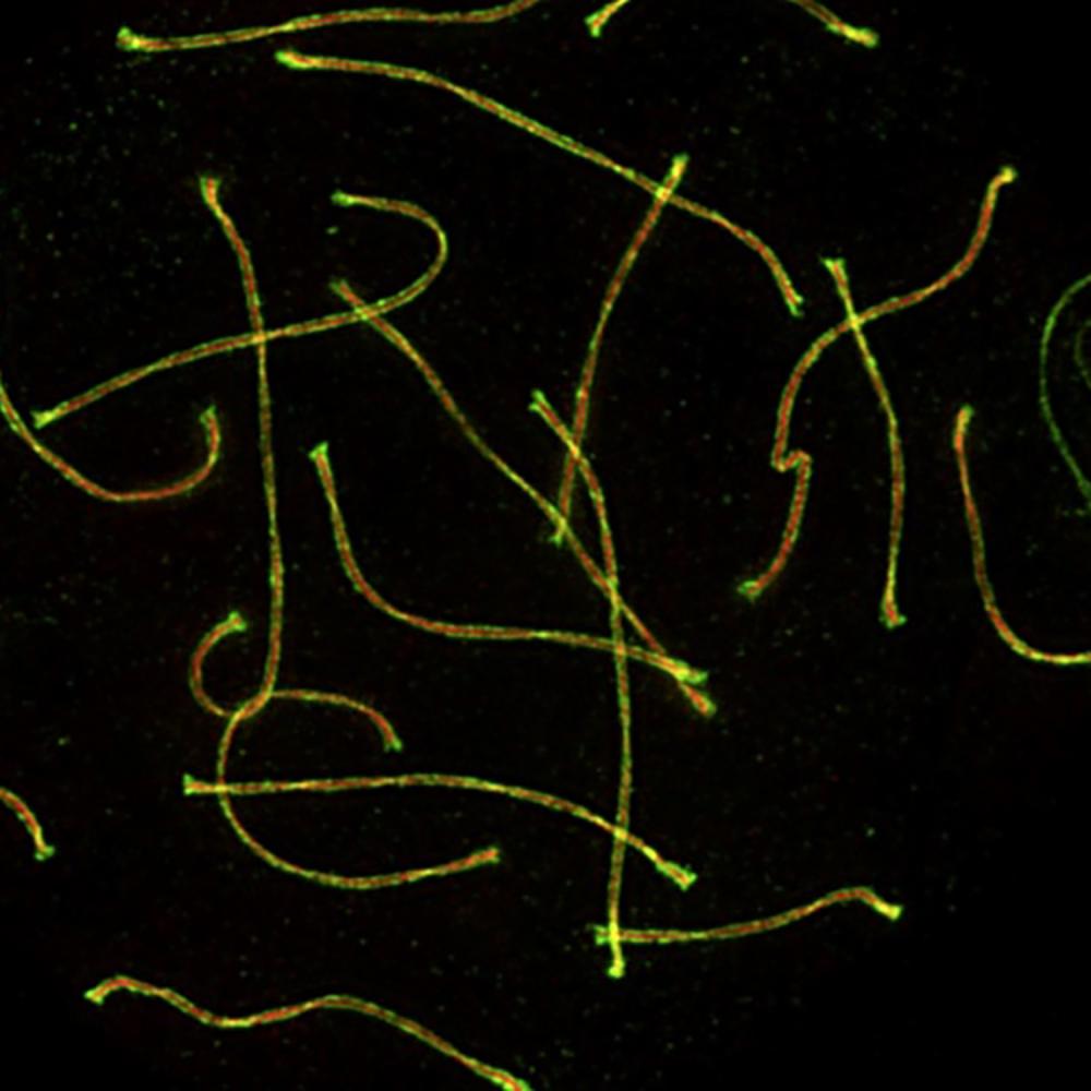 Fluorescent micrograph shows thread-like chromosomes with green and red labeling, illustrating cell division processes.