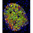 Pancreatic islets make insulin in response to blood glucose. In this image, cells are stained red for insulin and green for a marker of mature beta cells, so the mature cells are green/orange. Red cells at the edges are a newly discovered type of immature insulin-producing cell. Mark Huising/UC Davis