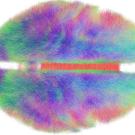 Big data visualization techniques like this connectome—a computer-generated map of the brain pathways of 20 humans—inform neuroscience and help create models of complex biological systems. Andreas Horn/Max Planck Institute for Human Development