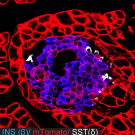 Red and purple micrograph of mouse pancreas cells