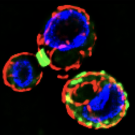 Septins (green), structural proteins common to all non-botanical eukaryotic life, were known to form rings that help separate mother and daughter cells during cell division (left). A new, student-led study has shown that septins are also involved in switching off autophagy, a recycling process within cells that is activated during times of stress, which they do by rearranging into localized patches that are scattered around the cell membrane (bottom right). (Ken Kaplan/UC Davis)